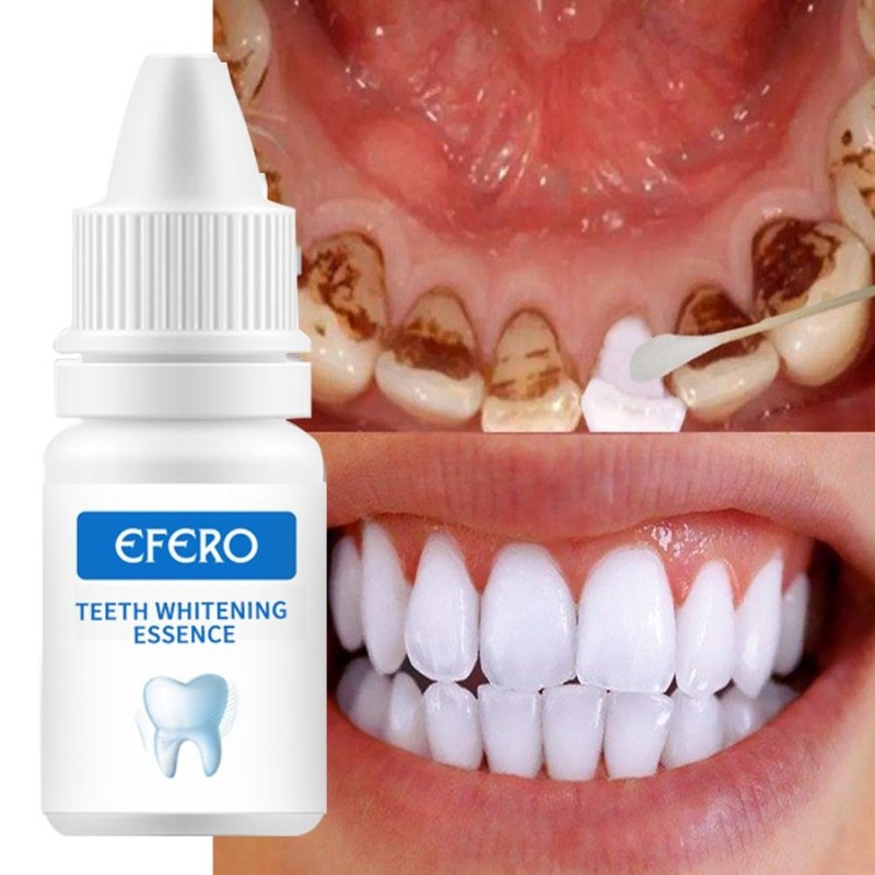 Soro branqueador de dentes - gel - higiene oral - pasta de dentes