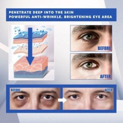 Creme removedor de bolsas nos olhos para homens - anti olheiras e inchaço - hidratante