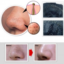 Blackhead & removedor de acne - limpeza profunda descascar a máscara facial 50 ml
