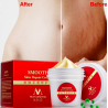 Marcas de estiramento e cicatrizes remoção creme de corpo de reparação