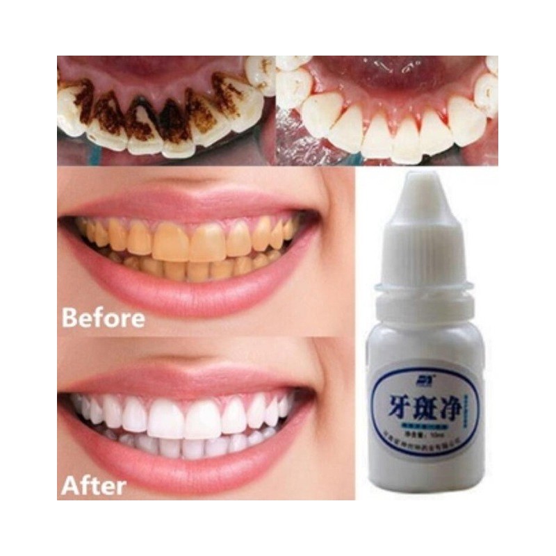 Água de branqueamento de dentes 10 ml