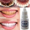Água de branqueamento de dentes 10 ml