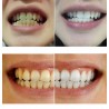 Água de branqueamento de dentes 10 ml