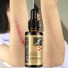 Lavender massage oil - scar removal - anti acne - hyaluronic acid serumMassage