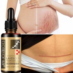 Lavender massage oil - scar removal - anti acne - hyaluronic acid serumMassage