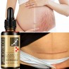Lavender massage oil - scar removal - anti acne - hyaluronic acid serumMassage