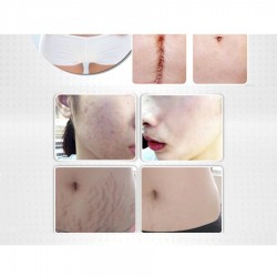 Lavender massage oil - scar removal - anti acne - hyaluronic acid serumMassage