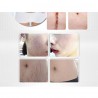 Lavender massage oil - scar removal - anti acne - hyaluronic acid serumMassage