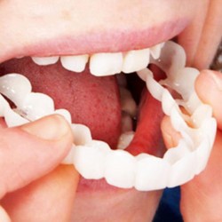 Tampa de dentes de silicone - prótese 2 peças