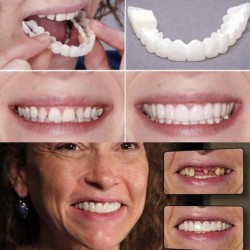 Tampa de dentes de silicone - prótese 2 peças